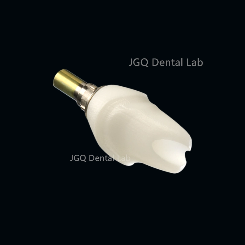 Dental Lab Custom Implant Abutments Titanium and Zirconia Used for Implant Cases