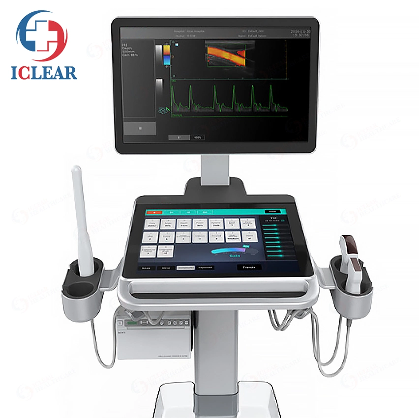 Trolley Ultrasound Scanner Color Doppler Medical Ultrasound System