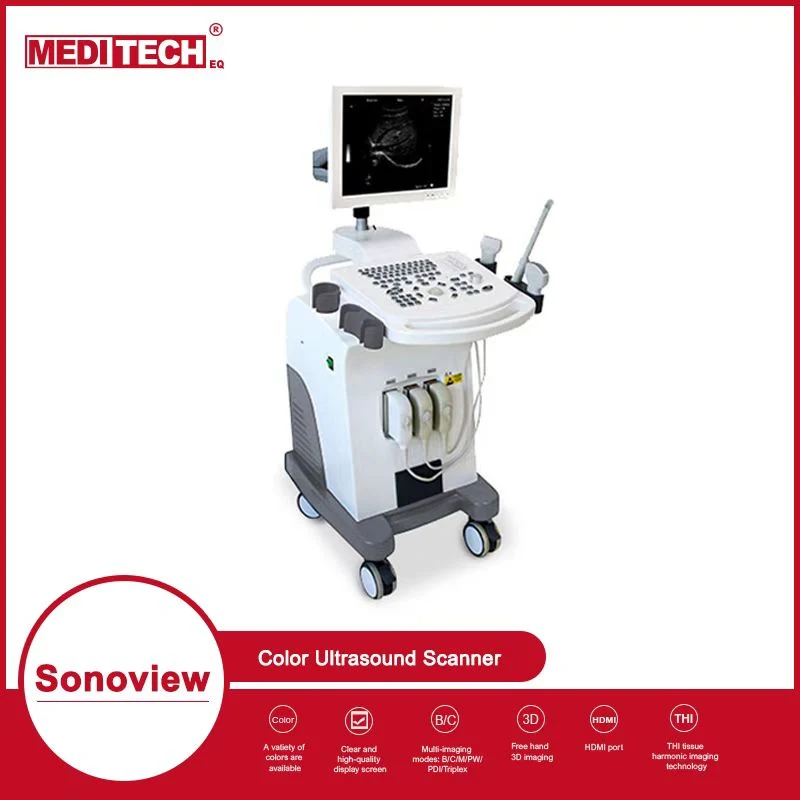 Full Digital Imaging Ultraschallscanner Sonoview Große Kapazität, Hohe Qualität