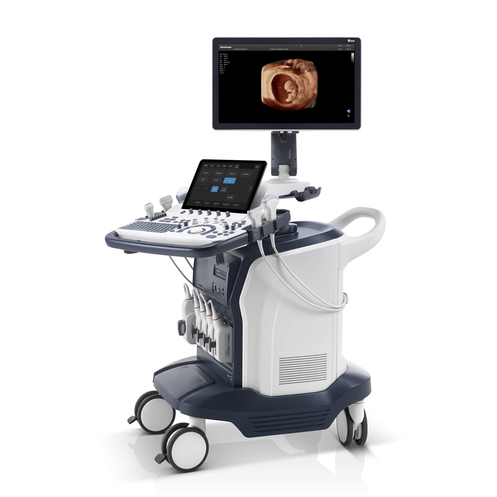 Sonoscape S60 13.3 Inch Quick Responsive Touch Screen Color Doppler Trolley Ultrasound Machine