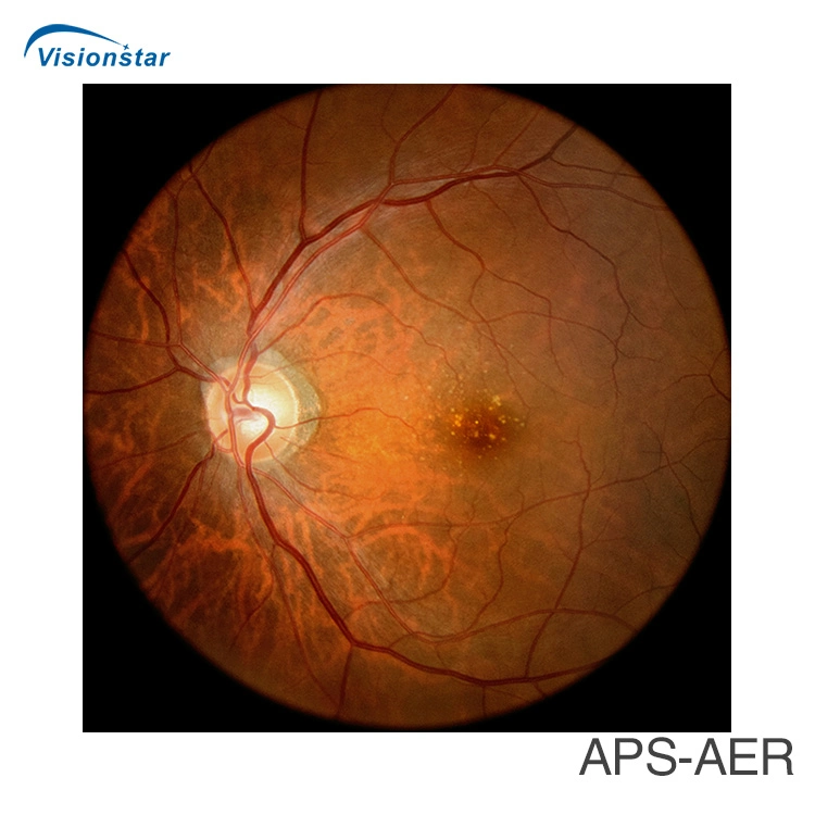 with Ce FDA Approved Fundus Camera