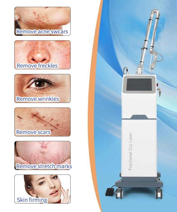 Fractional CO2 Laser Skin Removal Skin Care Tightening Beauty Machine RF CO2 Fractional Laser