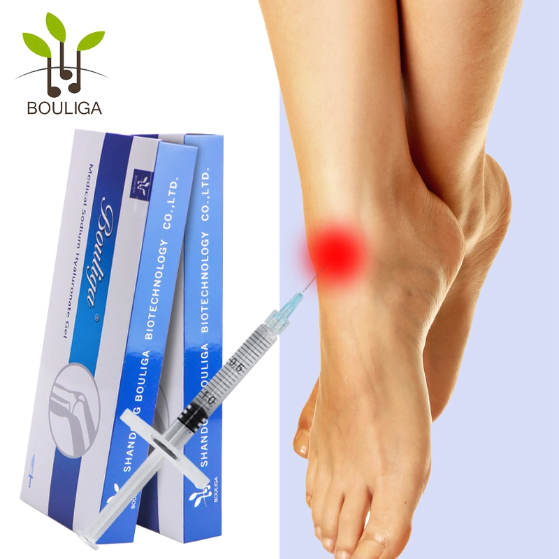 3ml 5ml de gel Hialurónico Inyectable rodilla ha llenado de conjunto de Inyecciones De Ácido Hialurónico Rodilla