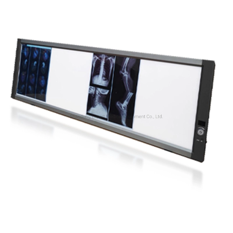 CE Certification X-ray View Boxes LED Double X Ray Film with Great Price