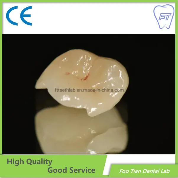 Professional Services Bruxzir Solid Stable Zirconia Bridge From China Dental Lab