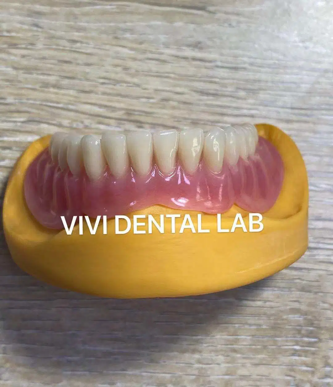 Acrylic Denture - China Dental Lab Denture in Good Quality and Good Esthetics