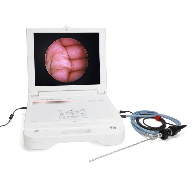 Système de caméra endoscopie médicale moniteur Ent HD portable appareil photo endoscope Unité