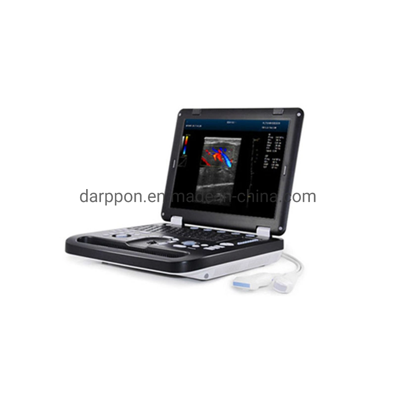 Portable 2D/3D/4D Ultrasound Machine/ Color Doppler Ultrasound Scanner