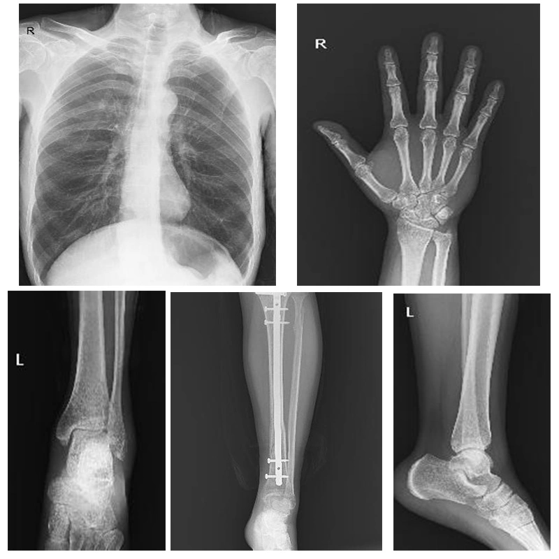 My-D049r Medical Hospital Instrument الأجهزة المحمولة لأجهزة الأشعة السينية الرقمية المحمولة