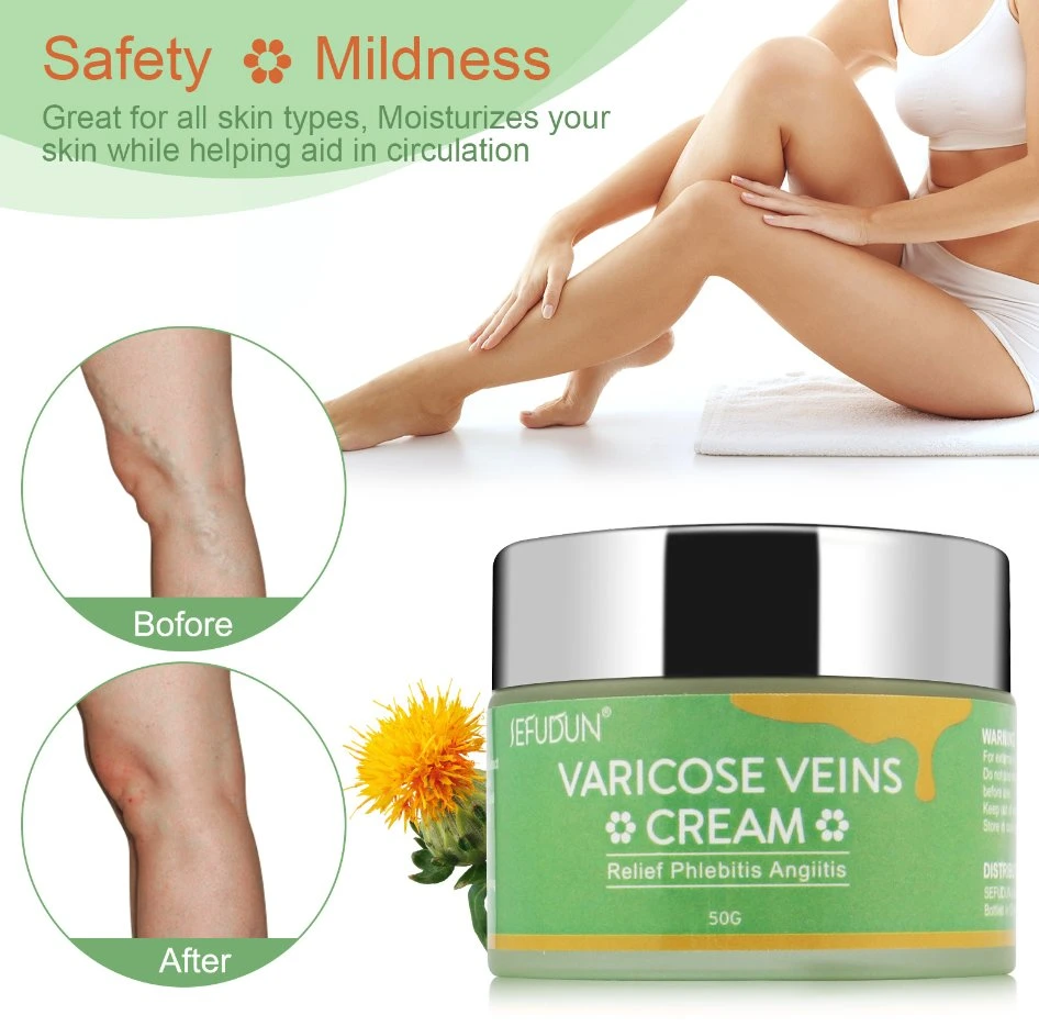 Wholesale/Supplier Effective Varicocele Treatment Relief Soothing Ointment Original Vasculitis Varicose Vein Removal Repair Cream for Leg