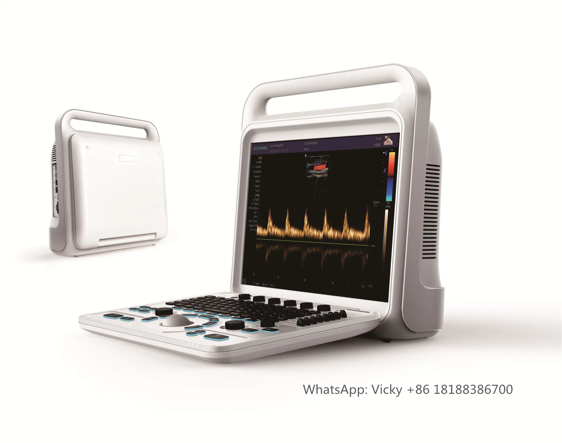 Touch Screen Color Doppler Diagnostic Instrument Manufacturer Trolley Ultrasound