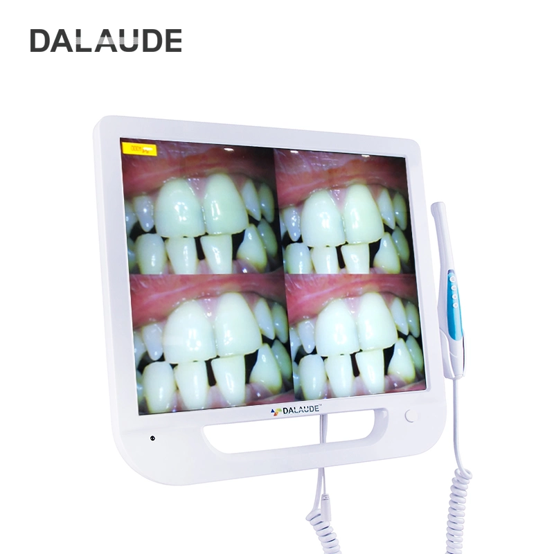 Unidad Dental de buen precio Cámara de video de fácil uso Endoscopio dental