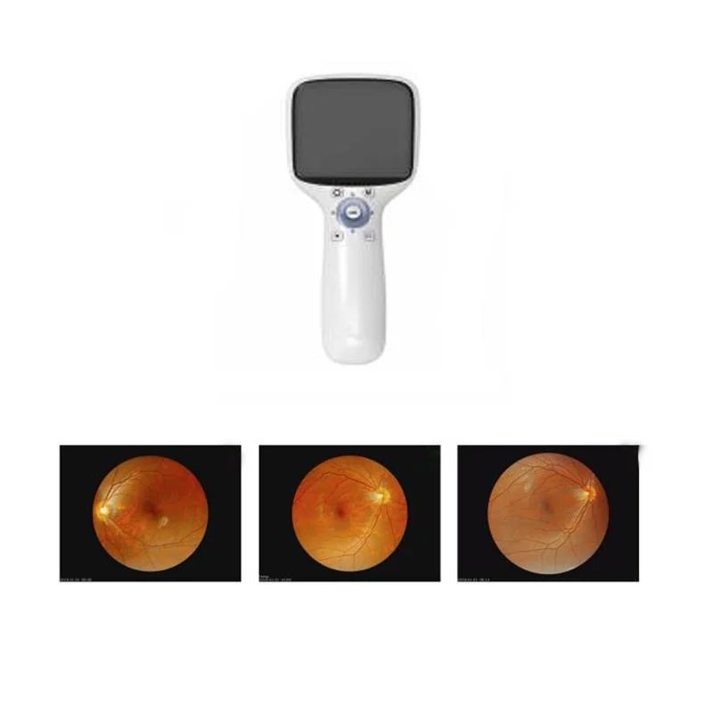 De Mano de veterinaria de la retina de la Cámara Digital Auto Fundus oftálmico Precio del equipo veterinario portátil Cámara Fundus Ojo Animal