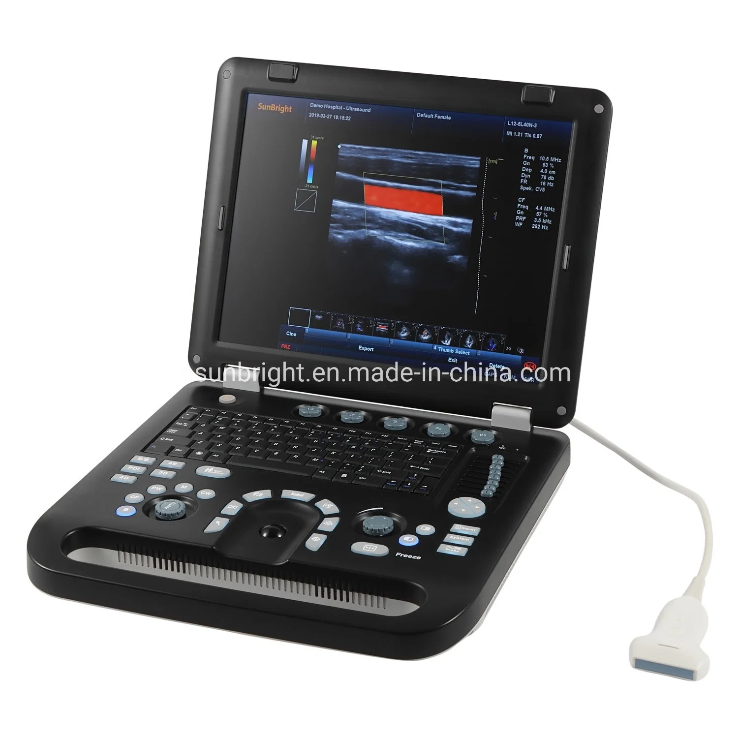 Ce Approved Portable Ultrasound Color Doppler Ultrasound Price Sun-906c 196 Elements