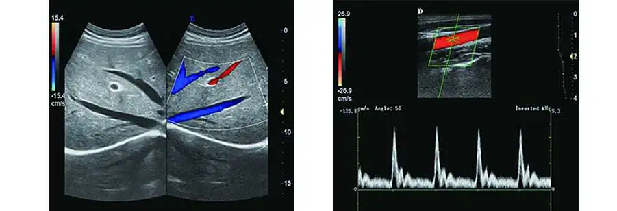 Full Digital Color Doppler Ultrasound Machine with Trolley (THR-USC900)