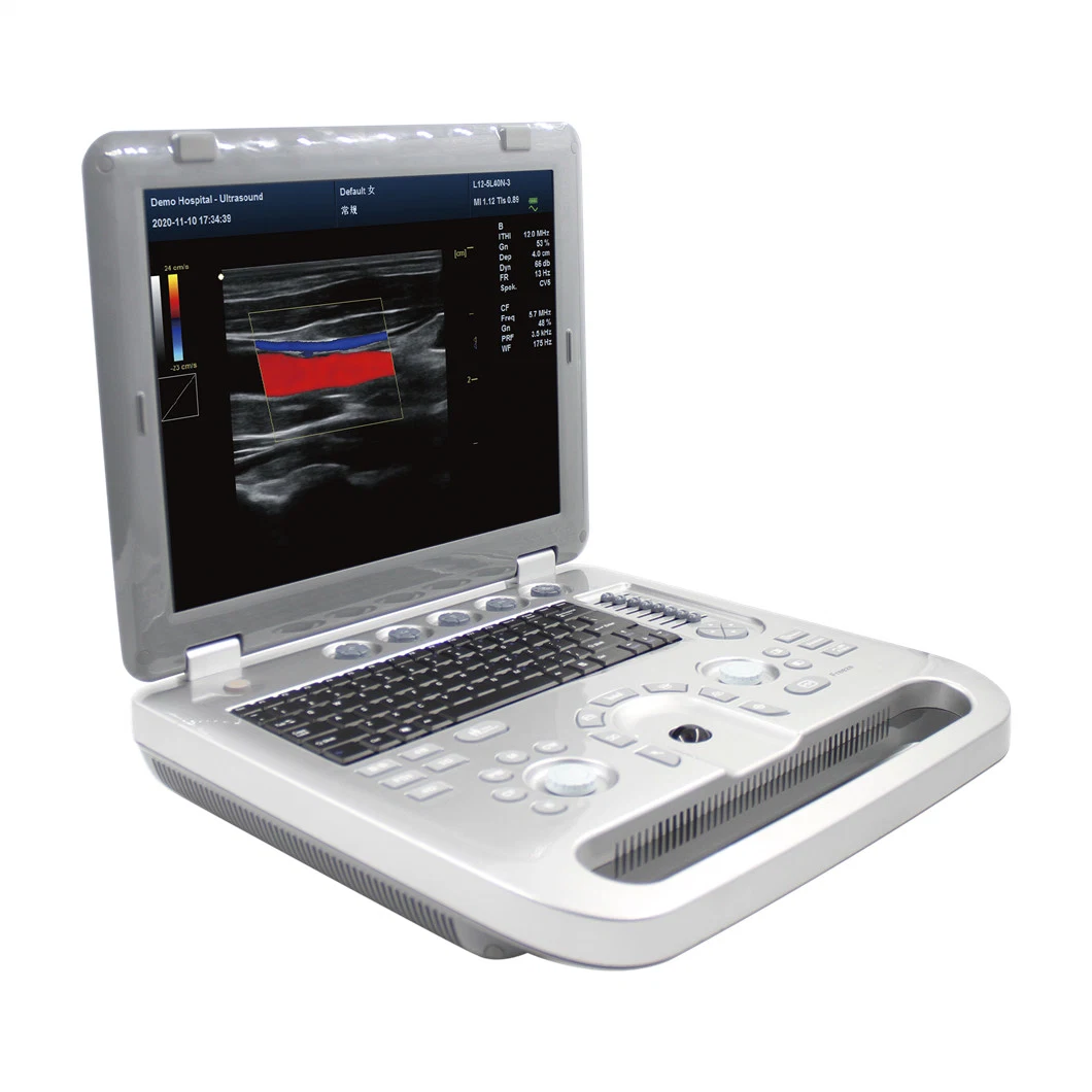 High quality/High cost performance Laptop Portable Color Doppler Ultrasound Scanner