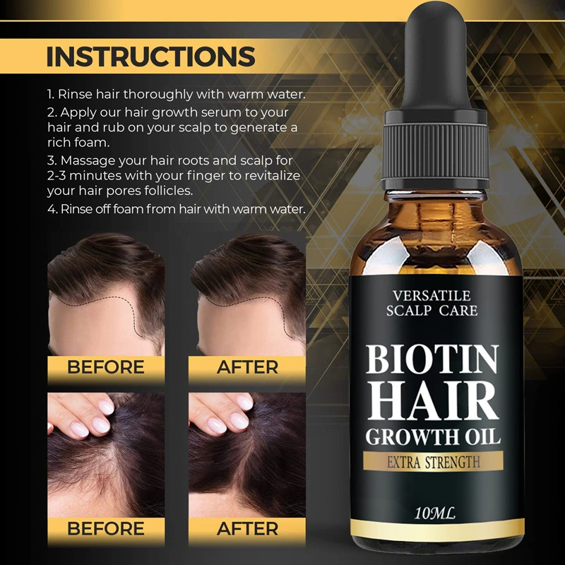 Minimise Hair Loss Hair Care Liquid Biotin Essential Oil Hair Enhancer Hair Growth Oil