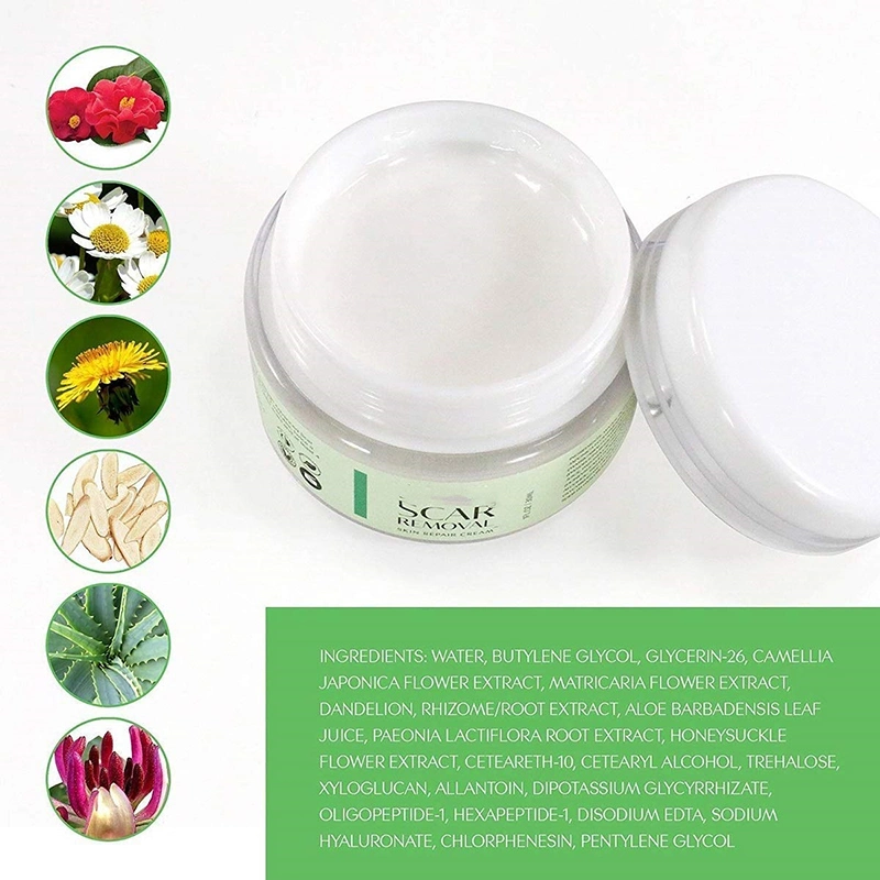 Removedor de cicatriz de cicatrizes antigas e novas de Silicone orgânicos naturais gravidez reparo cicatricial Gel cicatriz creme