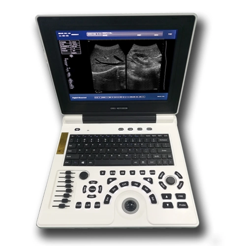 Xf30b Laptop Ultrasound Scanner Ultrrasound System