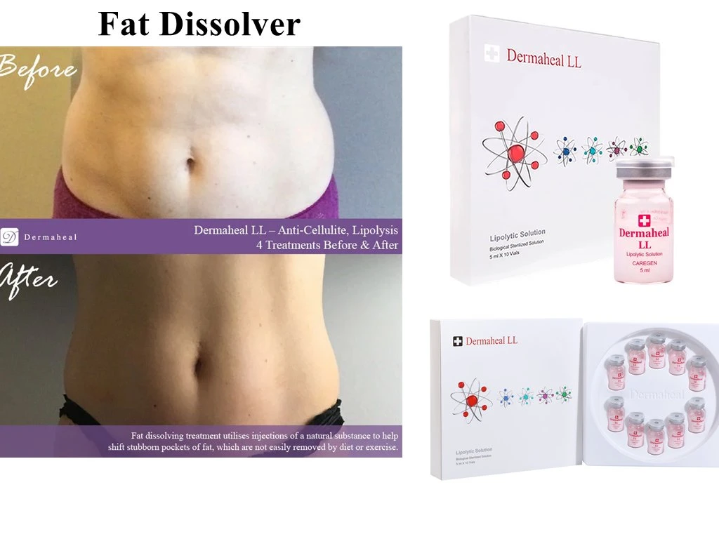 Dermaheal Ll Lipolytic Anti Cellulite Solution Review Before and After Slimming Lipo Solution Cellulite Lipo Lab Kabelline Kybella Lemon Bottle Treatment