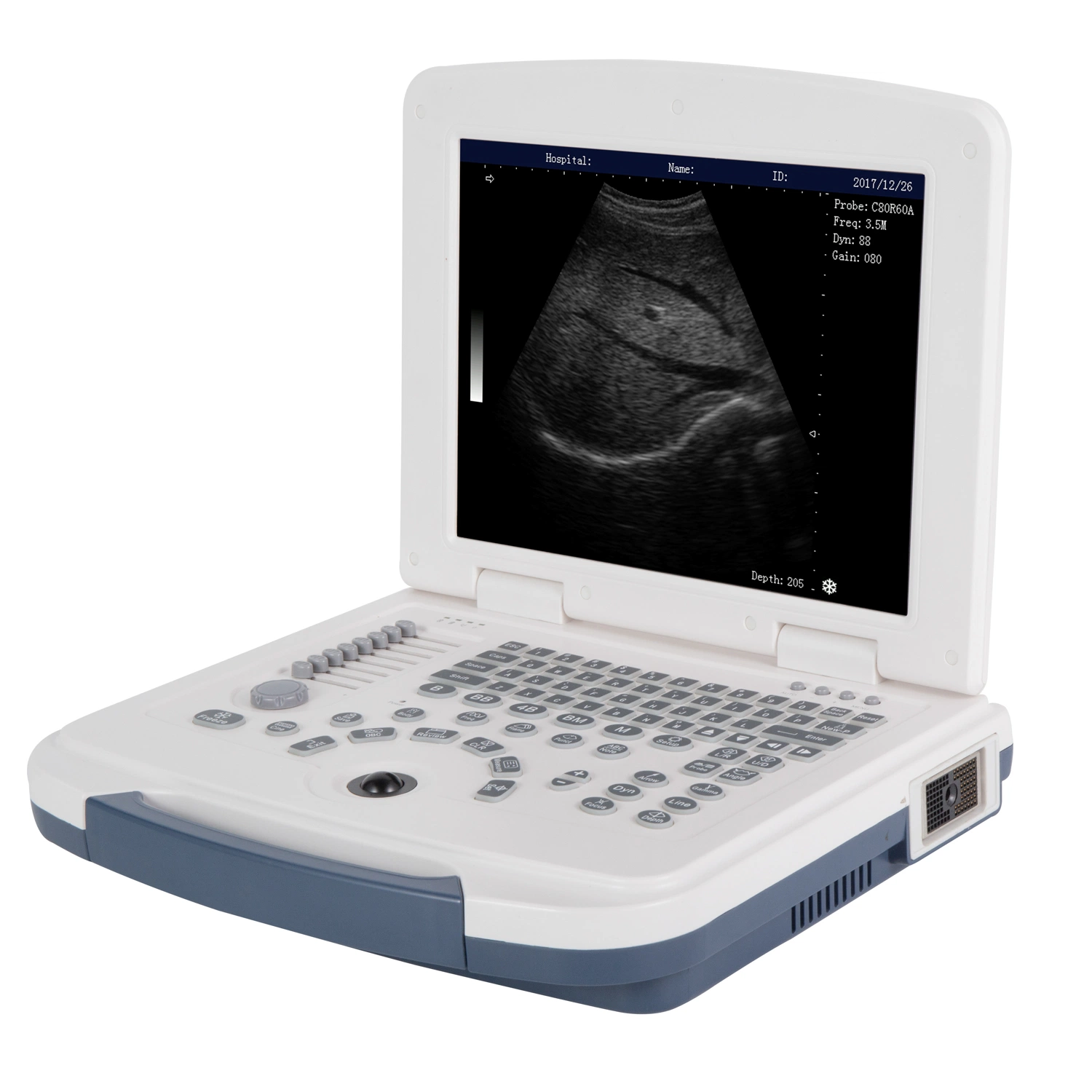 Fy580 Cheap Human Ultrasound Machine Medical Imaging Equipment