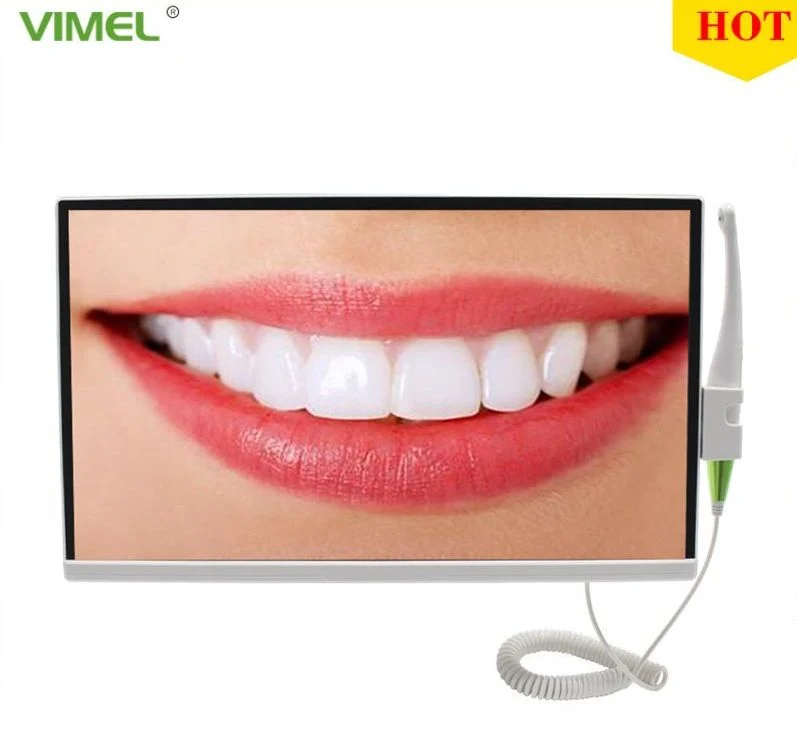 Dental Computer integrierte Endoskop HD Kamera Ai Image System