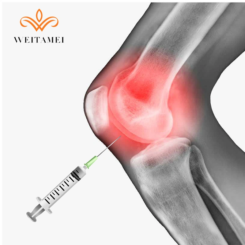 Los valores de fábrica 3ml de la cruz no vinculada a la osteoartritis de rodilla ácido hialurónico inyectable