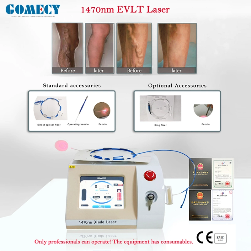 15W Medical CE 1470nm Endovenous Vein Laser Evltevla Diode Laser Device Endovenous Laser Treatment