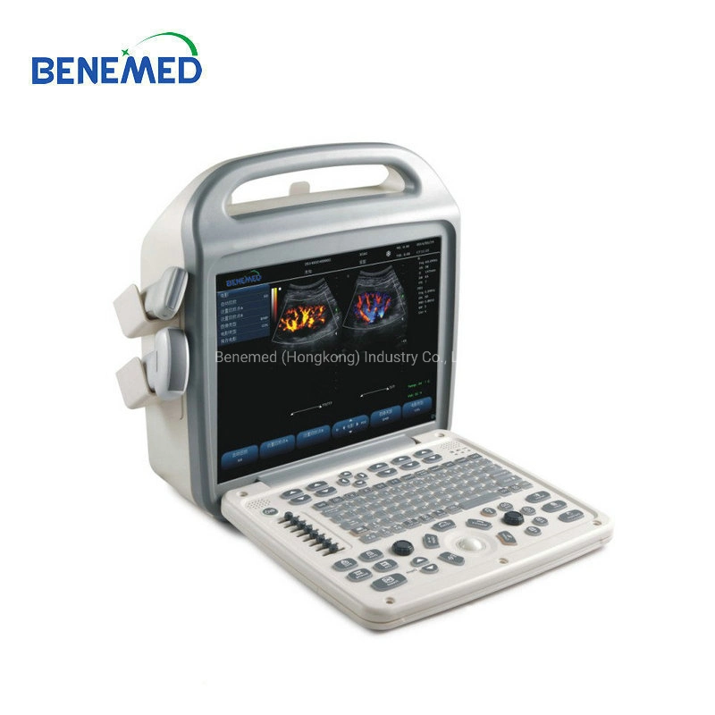 Popular Portable Color Doppler Ultrasound Scanner Diagnosis Equipment