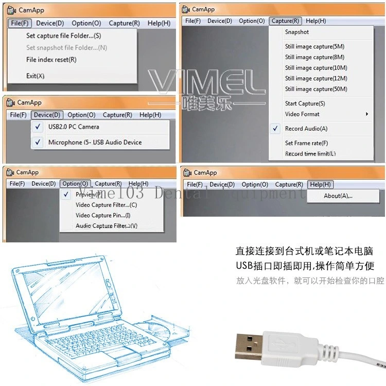 Equipos dentales oral dentro de la cámara USB Endoscopio