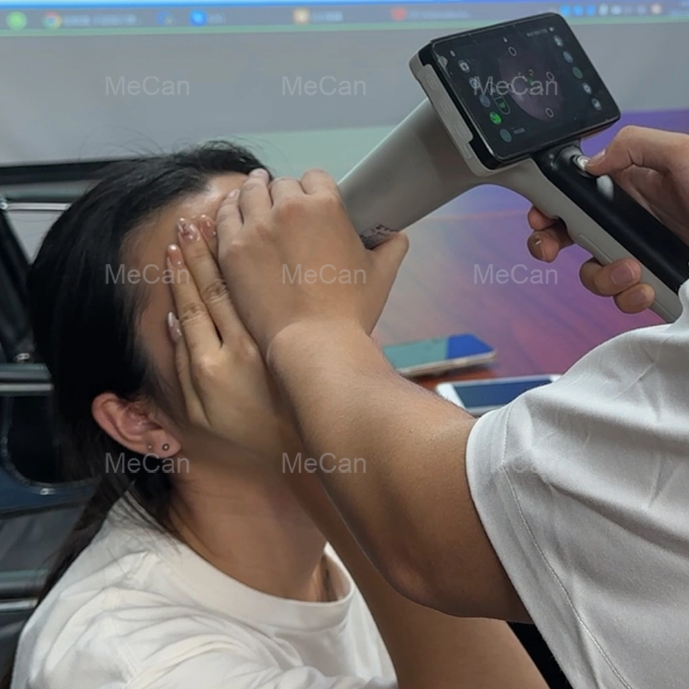 Handheld Portable Eye Preis Smartphone Handheld Fundus Kamera