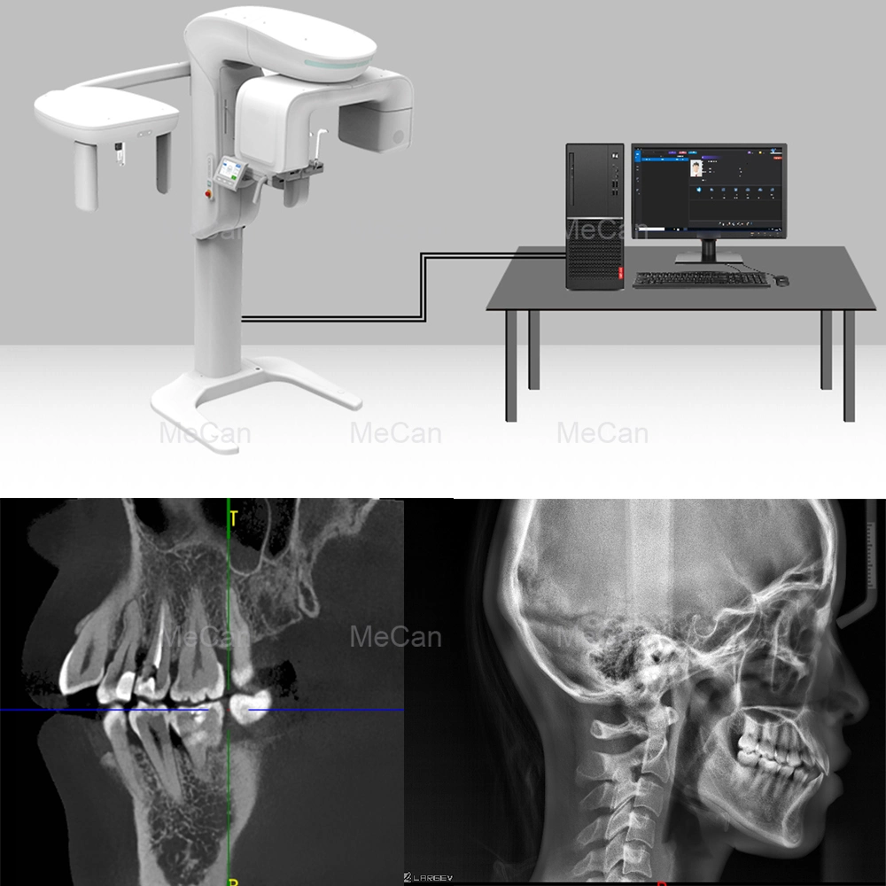 Medical 3D Digital Cbct Dental X Ray Panoramic X Ray Dental Machine