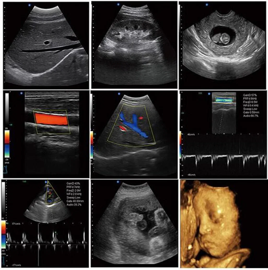 Sunbright New Updated Portable 4D Ultrasound Machine with Color Doppler Echo