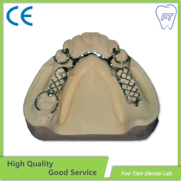 High quality/High cost performance  Removable Denture Cast Partial Framework Dental Customized