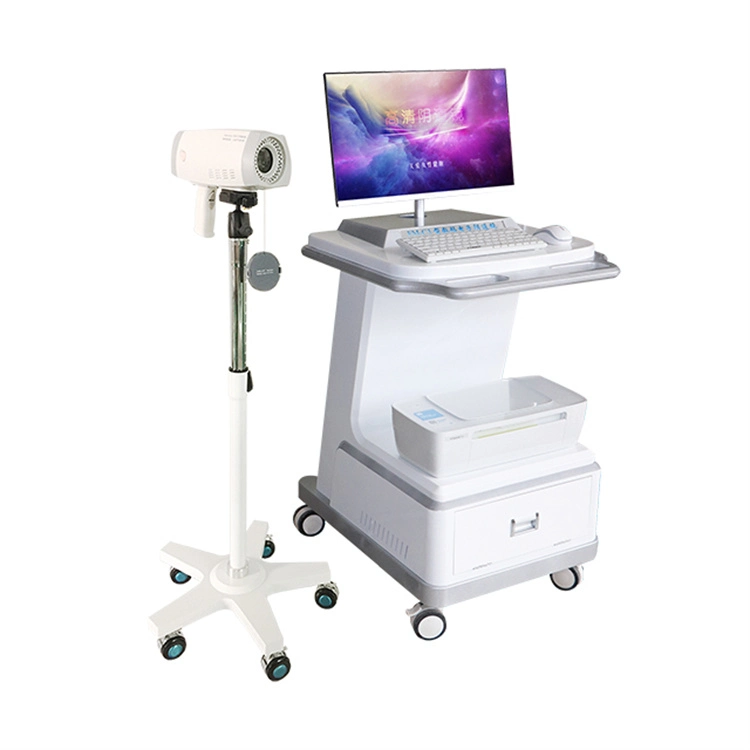 Portable Digital Vagina Colposcopy of Cervix Gynecology Colposcope Price