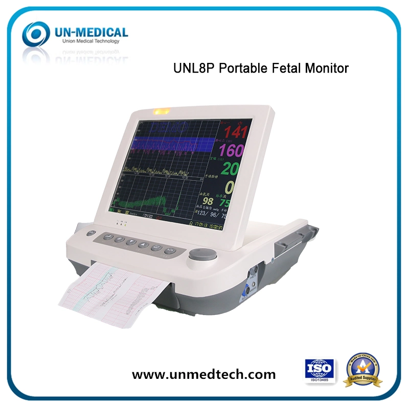 ECG/NIBP/SpO2 جهاز مراقبة الأم الجينية المحمول (UNL8P)