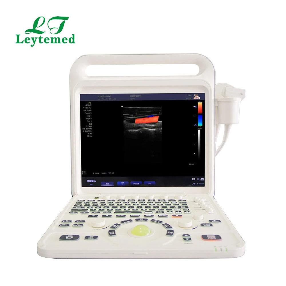 Ltub63 Urology Cardiac Gynecology Obstetric USG Color Doppler 4D Ultrasound-Machine