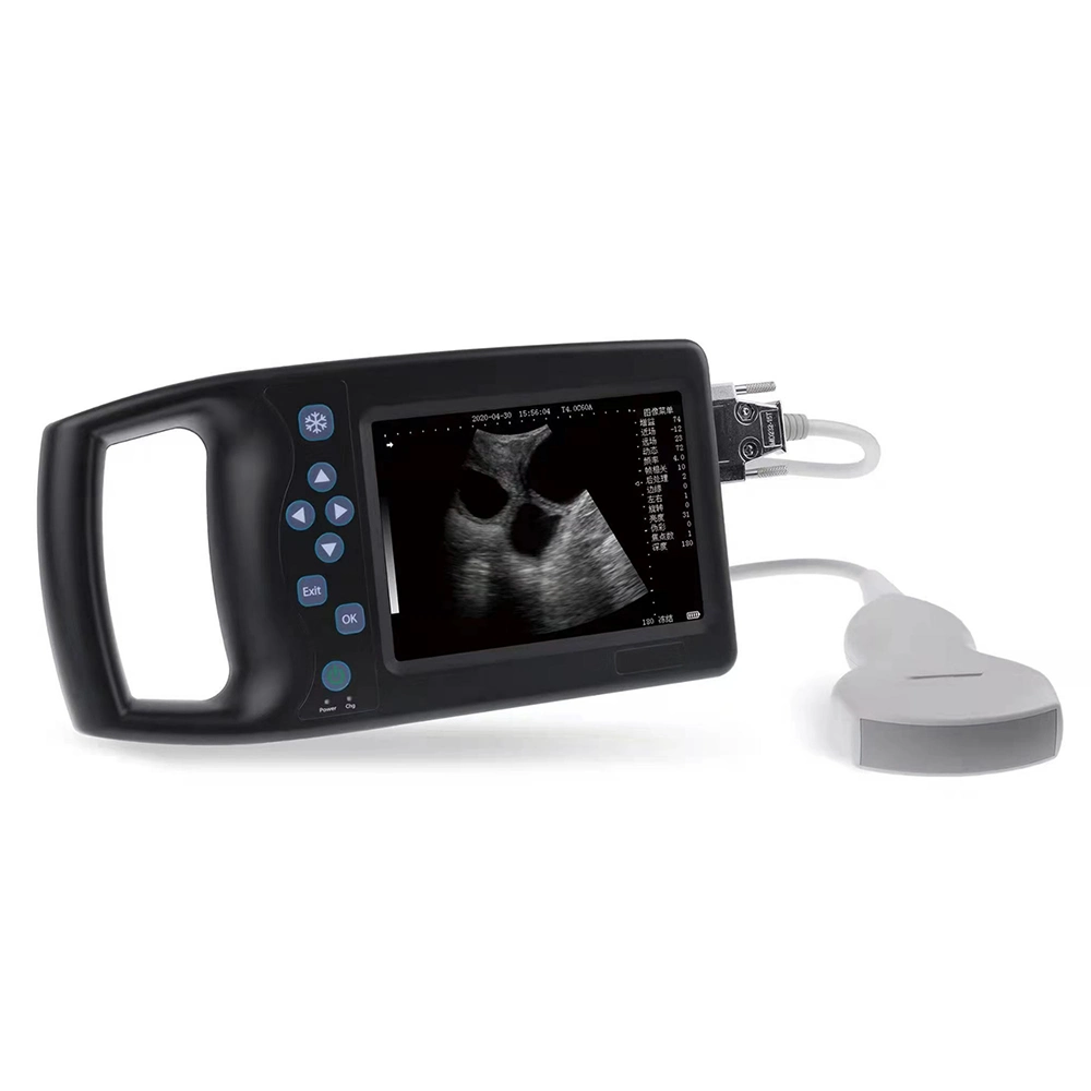 ICEN High Quality Hand-held Full Digital Veterinary Ultrasonic Diagnostic Imaging System