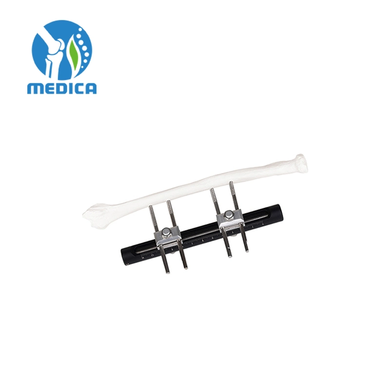 Trauma Orthopedic Single-Sided Integrated Joint External Fixation Elbow Joint External Fixator