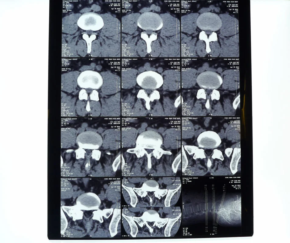 Utilisation de l'imprimante de l'hôpital médical sec radioactifs Blue Film d'impression thermique