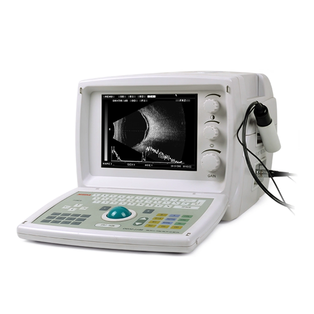 High quality/High cost performance Economic Ultrasound a/B Scan for Ophthalmology (ODM-2100S)