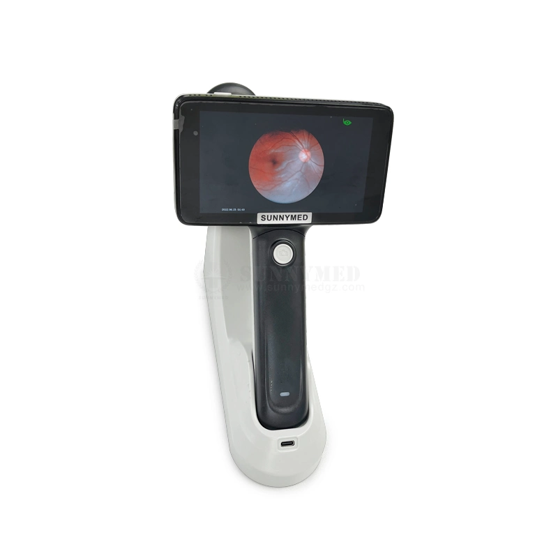 Sy-V042un ordinateur de poche médical de la fonction Auto Focus caméra Fundus ophtalmique Fundus portable appareil photo pour la vente à chaud