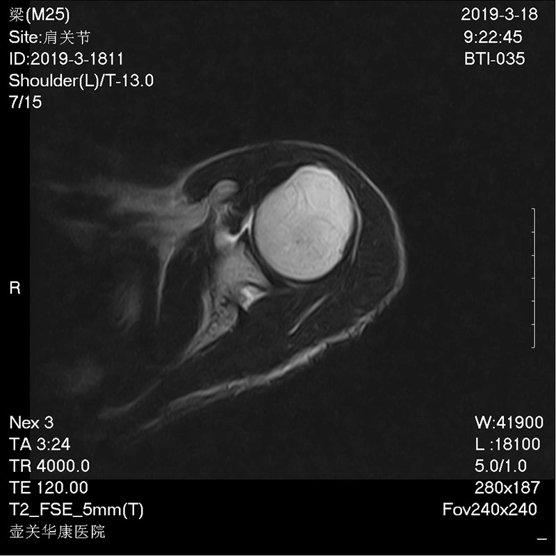 L'hôpital scanner IRM Nachine supraconducteur du système de prix