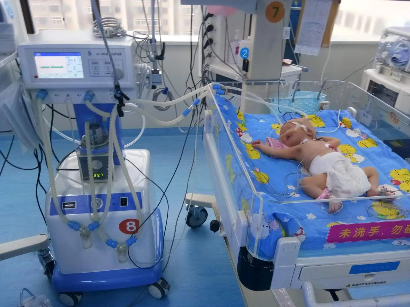 Big Screen Medical Ventilator CPAP Machine for New-Born Baby