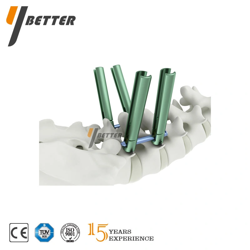 Thoracolumbar posterior Sistema de fijación de la columna vertebral de la columna vertebral de titanio, tornillos pediculares implantes ortopédicos, Ortopedia instrumentos, equipos médicos