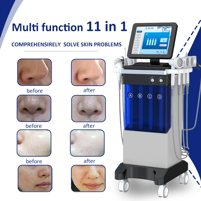 Nuevo centro de belleza cuidados de la piel piel facial inteligente sistema Azul hielo nueva máquina de Hydra