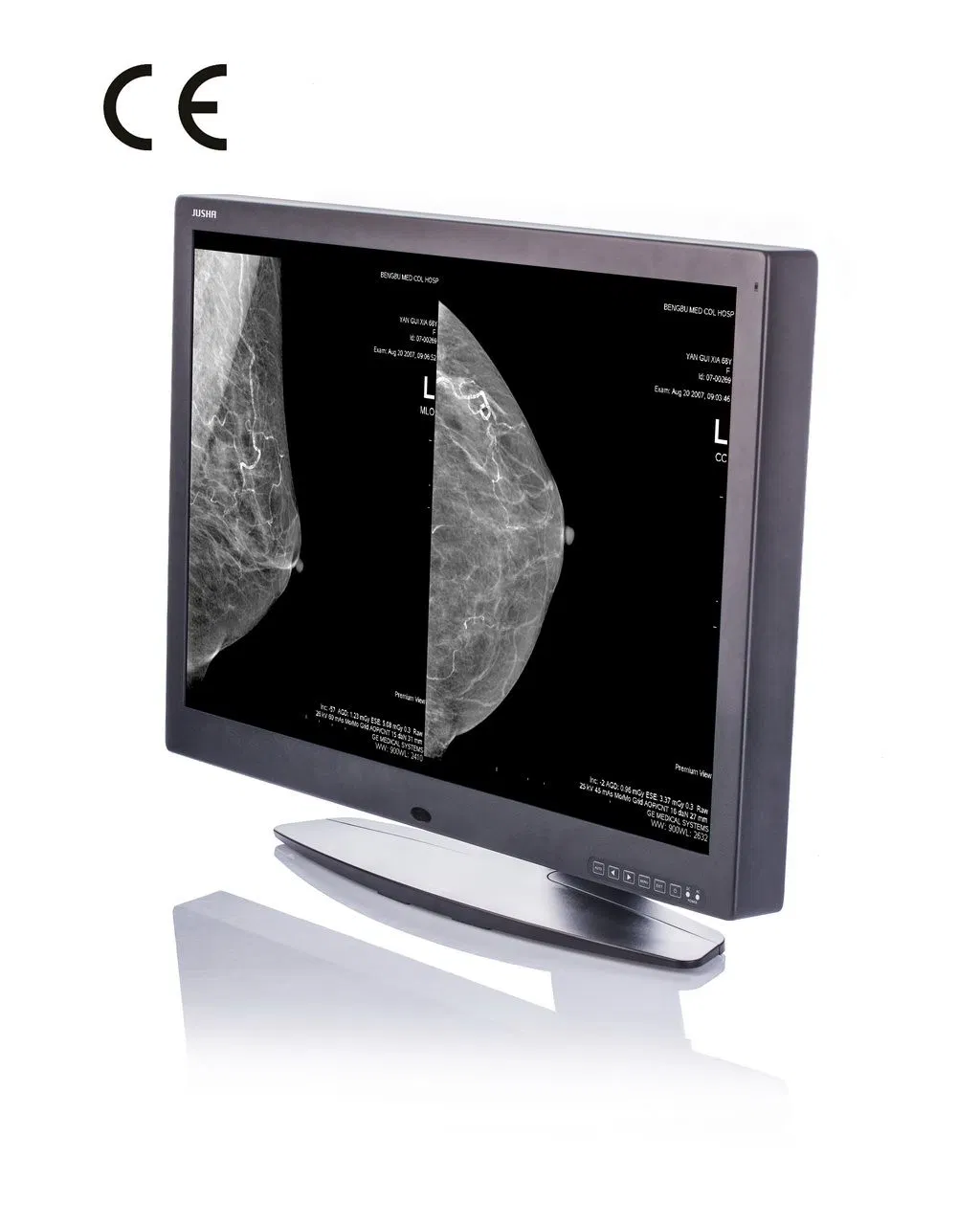 30inch 10MP High Resolution Display System for X-ray Medical Device, CE