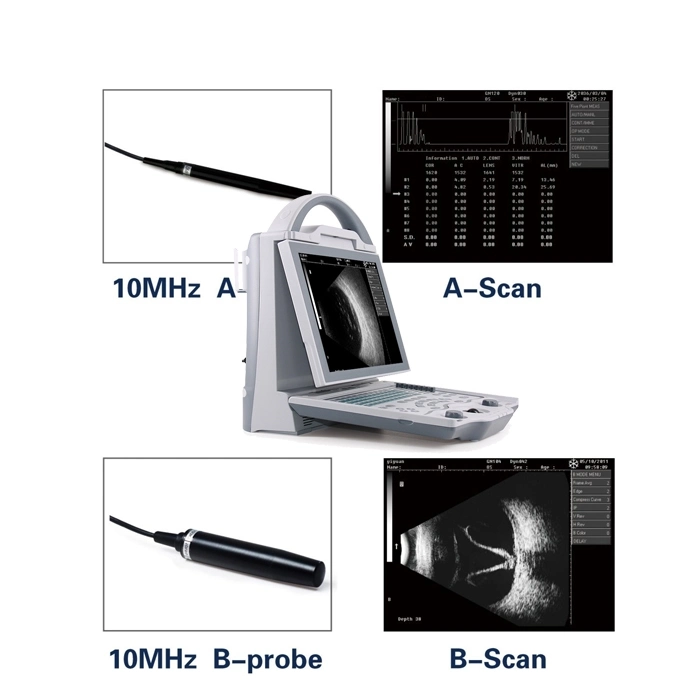 Portable Biometry Accuracy Full Digital Ophthalmic a/B Ultrasound Scanner