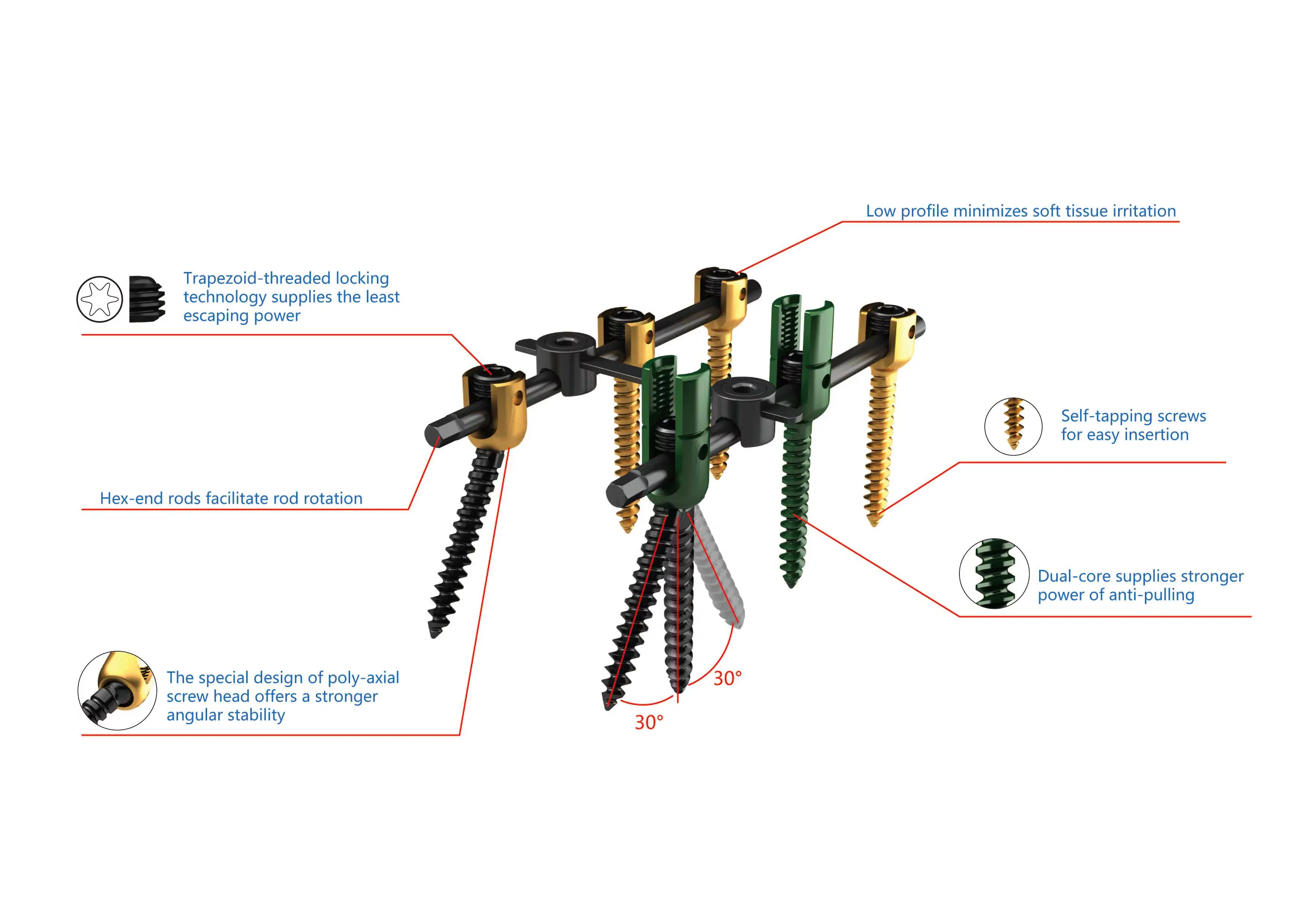 Pedicle Screws, Titanium Alloy, Orthopedic Implant, Spine, Surgical, Medical Instrument Set, with CE/ISO/FDA, Dislocation, Fracture, Lumber and Cervical Verterb