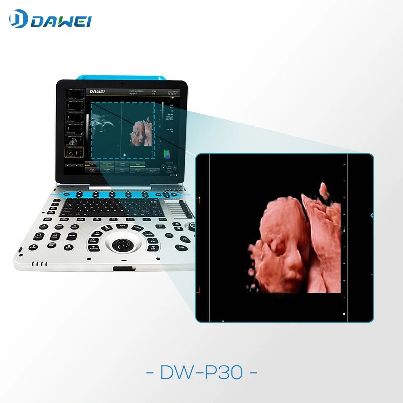 Dw-P30 Portable 3D/4D/5D Real Skin HD Live Ultrasound Machine for Pregnancy